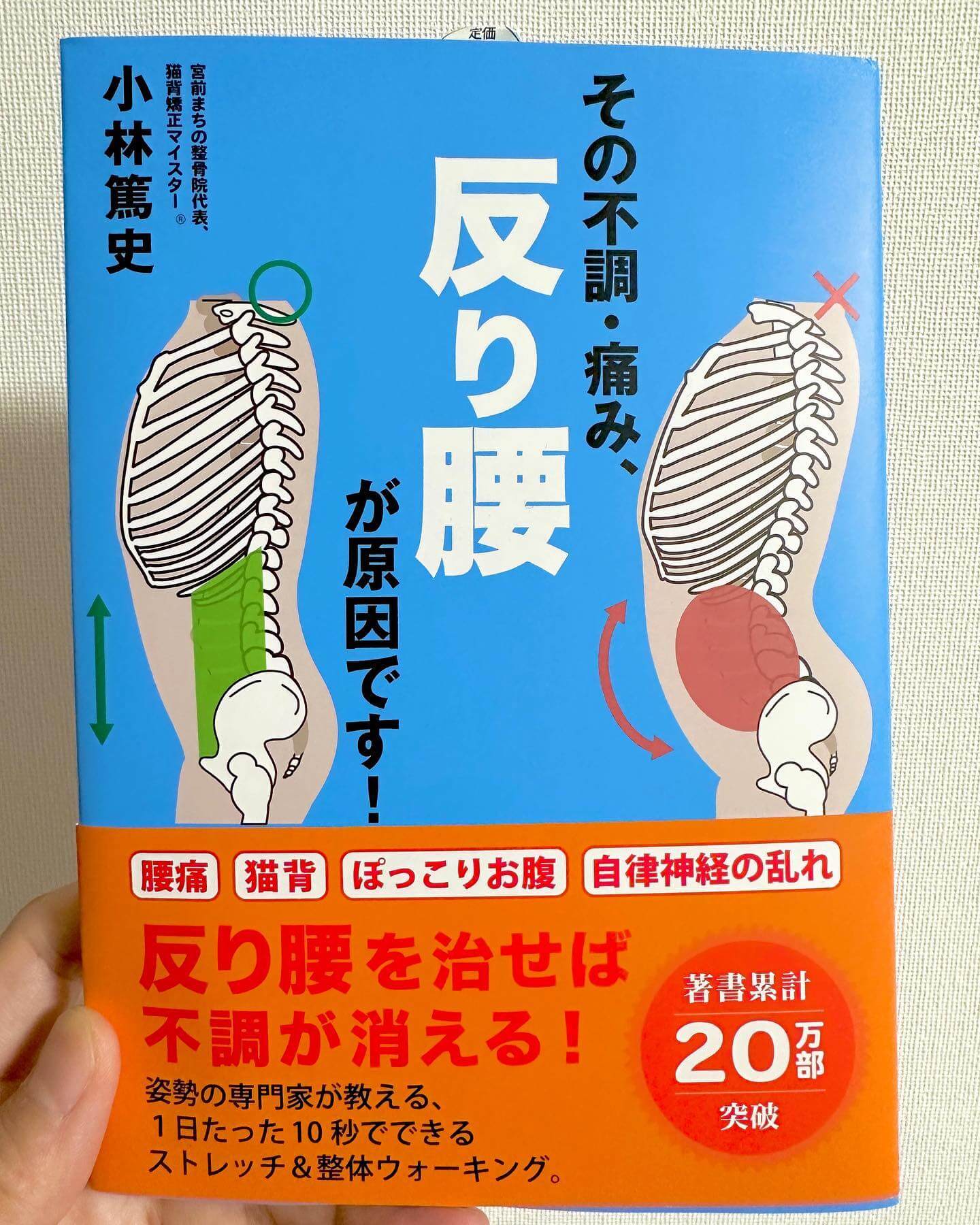 反り腰 反り腰