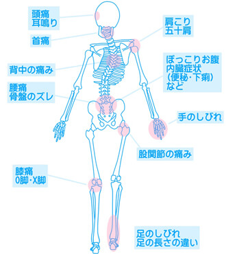 ゆがんだ骨格 ゆがんだ骨格